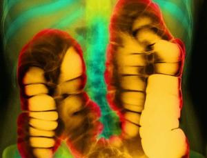 බඩගිනි අඩුකිරීමට බැක්ටීරියා&nbsp;අපද්‍ර‍ව්‍ය