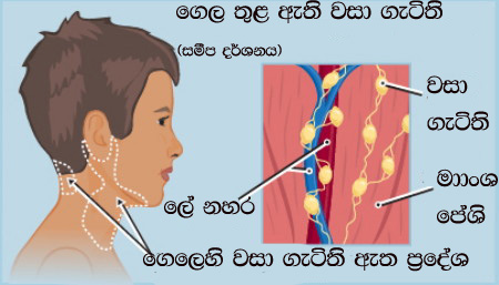 අප බේරා ගැනීමට සටන් වදින ප‍්‍රතිශක්තිකරණ&nbsp;පද්ධතිය