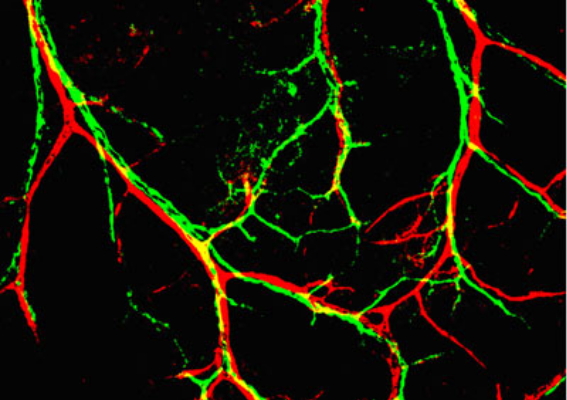 ස්නායු ක්‍රියාකරන අන්දම&nbsp;1