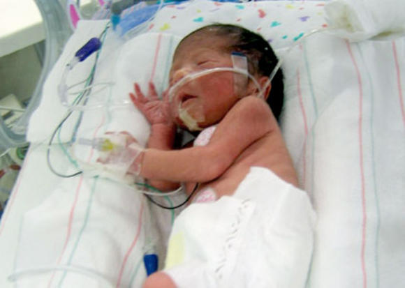 ප්‍රාග් පරිණත උපත් ස්වීයත්වයට&nbsp;බලපායි