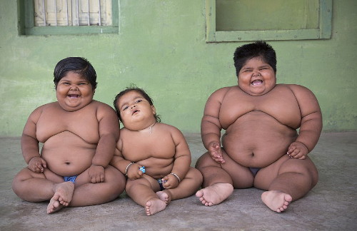 අසාත්මිකතාව හා ස්ථූලභාවය, හෘදයාබාධ අතර සම්බන්ධයක්&nbsp;?