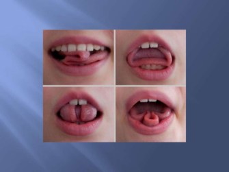 dominant-and-recessive-traits-in-humans-15-728