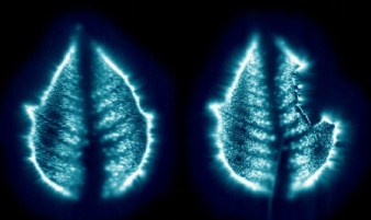 From Online Gallery: Kirlian Photography