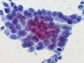 5476839031_cdea76b52c_o-jpg__800x600_q85_crop