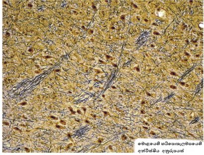 මොළයෙහි පිහිටි වයස්ගතවීමේ යාන්ත‍්‍රණය සොයා&nbsp;ගැනේ