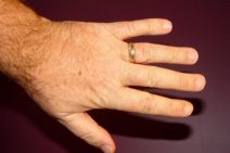 අපේ  ඇඟිලි පහ එකවගේ නැත්තේ&nbsp;ඇයි?