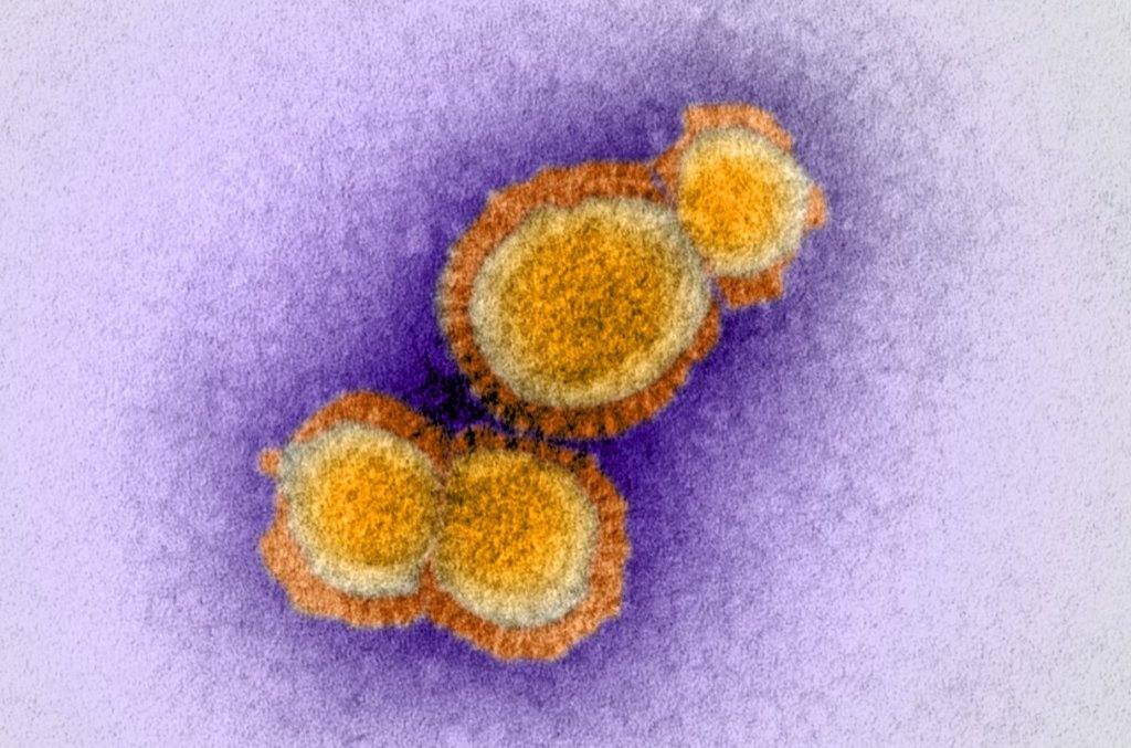 ලොව වඩාත්ම ගුප්ත භාෂා පවුලක බිහිවීමට කෘෂිකර්මාන්තය මගපෑදූ&nbsp;හැටි